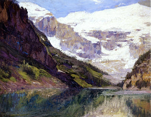  Edward Potthast Lake Louise - Art Print